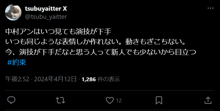 中村アン　同じ演技　演技が下手